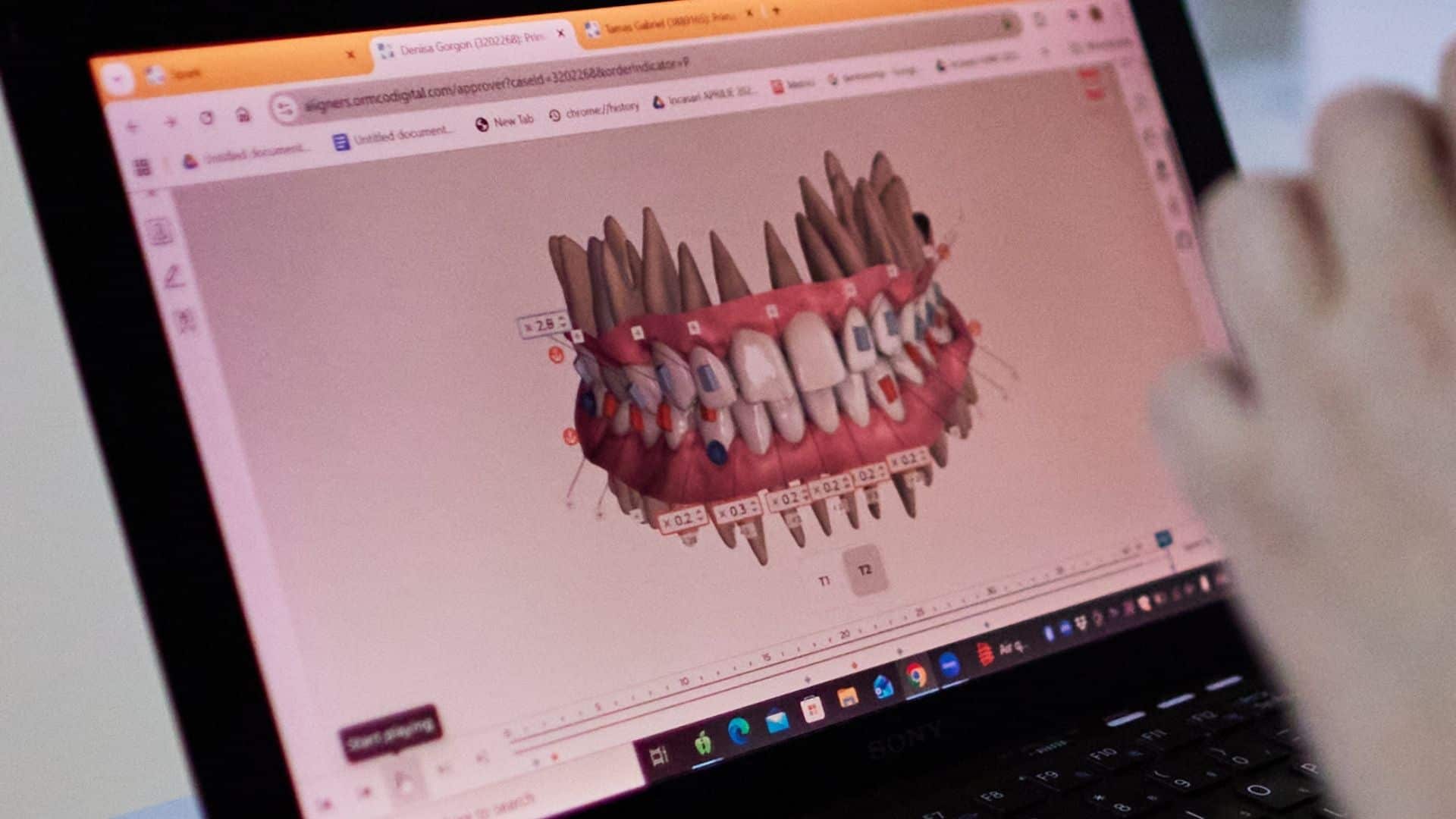 planificare-digitala-gabriel-tamas-dentaline
